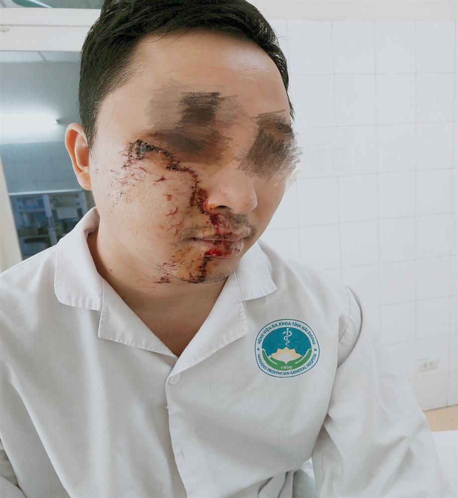 Chấn thương hàm mặt - Nguyên nhân, triệu chứng và cách xử trí